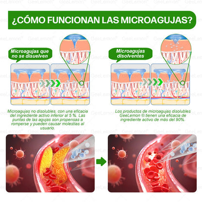 👇GeeLemon® tiene una mejora sorpresa solo para ti. Ya tenías una oferta increíble, pero ahora has desbloqueado una aún mejor: obtén un 50% de descuento en tu próxima compra, solo durante los próximos dos minutos.